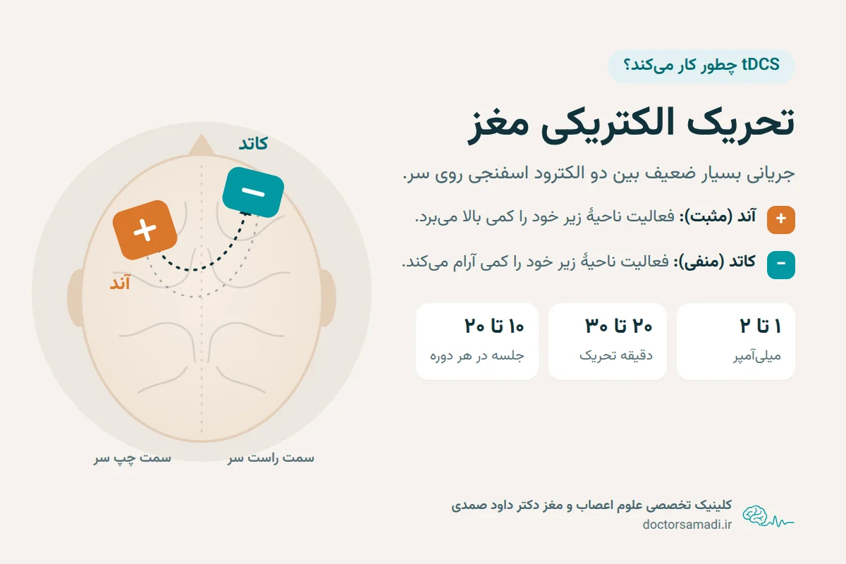 نمودار tDCS: الکترود مثبت (آند) روی پیشانی چپ فعالیت مغز را کمی بالا می‌برد و الکترود منفی (کاتد) روی پیشانی راست آن را کمی آرام می‌کند؛ جریان ۱ تا ۲ میلی‌آمپر، ۲۰ تا ۳۰ دقیقه.